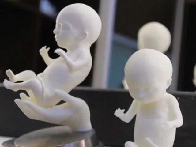 رحم میں موجود بچے کا ہوبہو تھری ڈی ماڈل تیار کرائیں